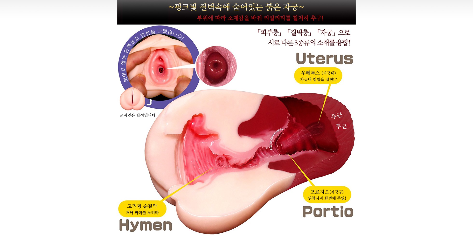 극채 우테루스 설명