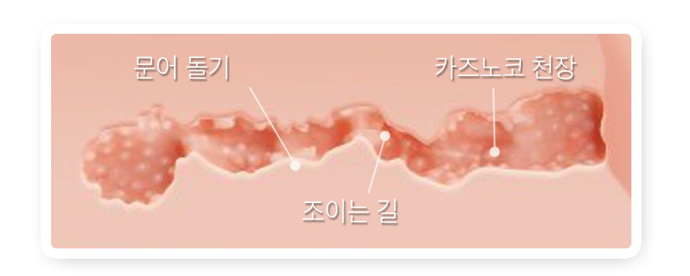 버진 악녀 세세한 돌기들과 주름이 비틀리며
당신을 감싸줍니다.